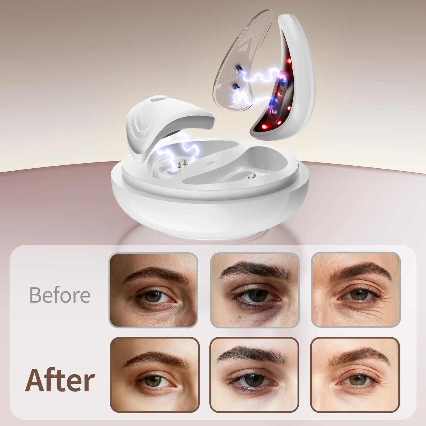 EMS Redlight Eye Massage Eyes Beauty Device with under Eye Patches Portable Eye Rejuvenation Pads Reduce Bags & Dark Circles